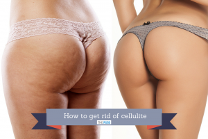 How to get rid of cellulite TheFuss.co.uk