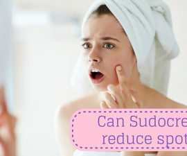 Can Sudocrem reduce spots? TheFuss.co.uk