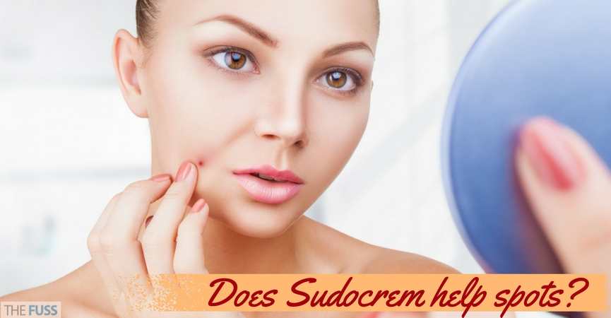 Does Sudocrem help spots? TheFuss.co.uk