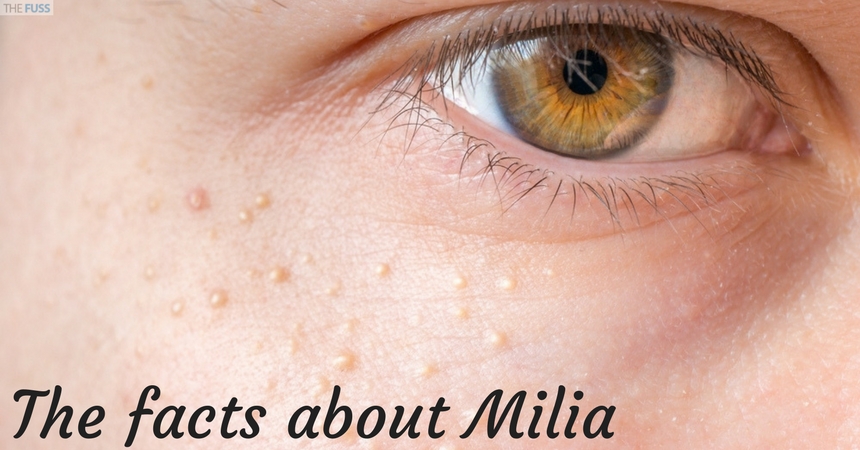 The facts about Milia TheFuss.co.uk